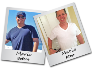 Weight Loss Before and After - Mario - Carrington Medical Spa Trussville Alabama