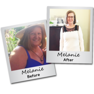 Weight Loss Before and After - melanie - Carrington Medical Spa Trussville Alabama