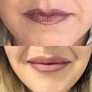 a before and after image of a woman’s lips